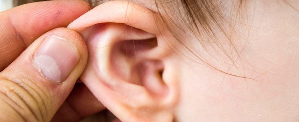 Luôn sử dụng kháng sinh điều trị viêm tai giữa có phải là cách tốt nhất