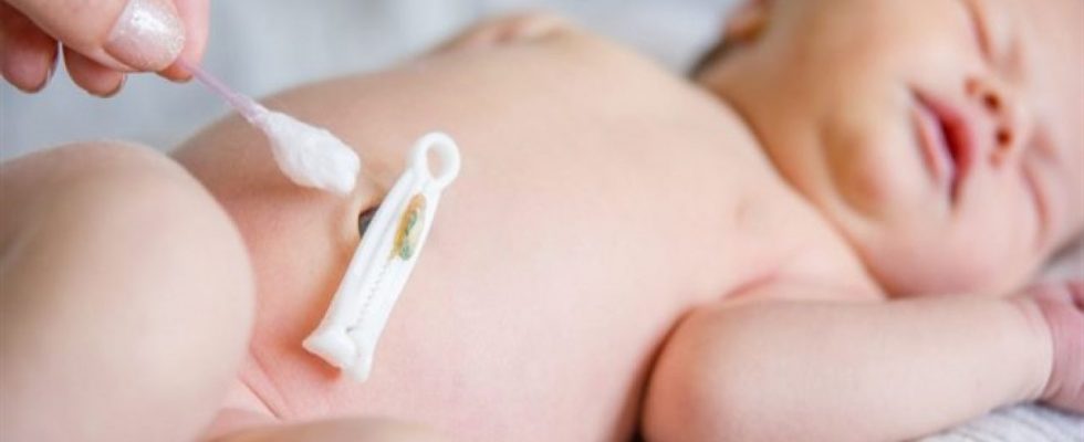 Kẹp rốn muộn là gì? Lợi ích của việc kẹp rốn muộn đối với trẻ sơ sinh khi chào đời