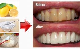 Mẹo hay giúp răng trắng sáng nhanh chóng
