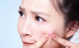 Trị thâm mụn tại nhà