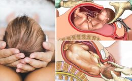 Giữa sinh thường và sinh mổ cái nào có lợi hơn?