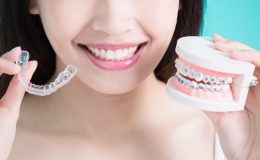 niềng răng uy tín