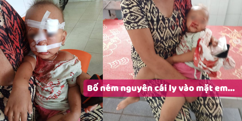 Nghi do bị bố ruột bạo hành, bé gái mặt mũi đầy máu được mẹ bế vào bệnh viện cấp cứu