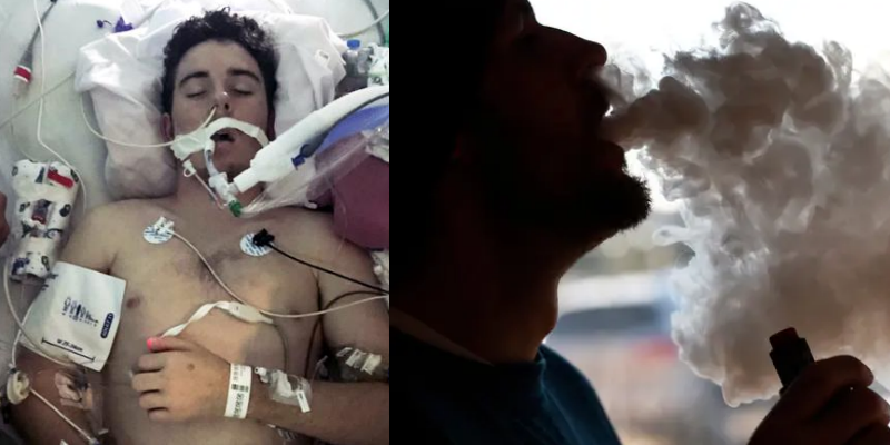 Chàng trai 18 tuổi hư phổi trái vì hút Vape, tiết lộ sự thật độc hại về Vape mà bạn nên biết