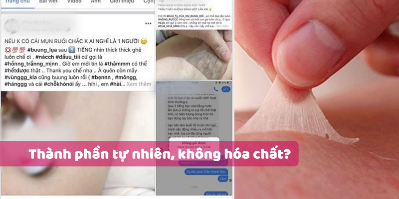Dùng liệu trình lột da tẩy thâm nách theo tư vấn, cô gái trẻ bất ngờ khi nhìn vào lớp da sau khi lột