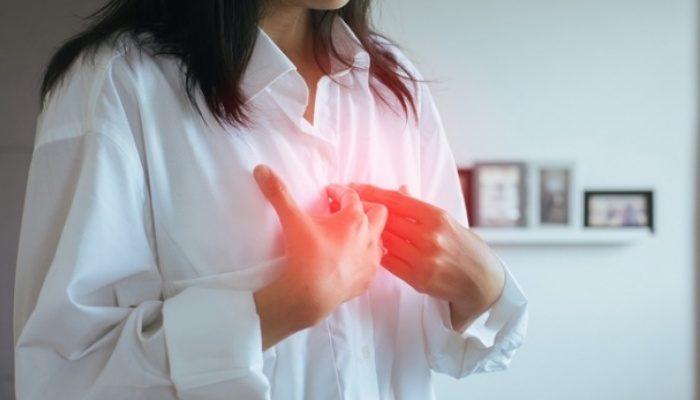 Trào ngược dạ dày