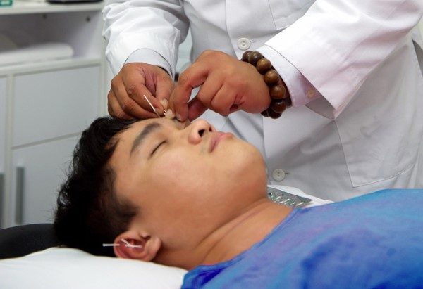 Chứng đau nửa đầu và phương pháp điều trị đau nửa đầu