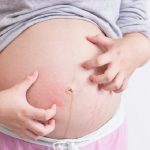 Đừng chủ quan nếu bạn thường xuyên bị ngứa trong thai kì