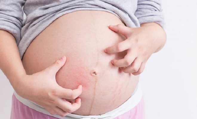 Đừng chủ quan nếu bạn thường xuyên bị ngứa trong thai kì
