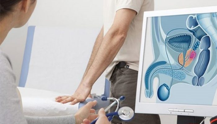 ung thư tuyến tiền liệt
