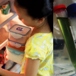 Ăn thức ăn bị hư hại, bé gái 6 tuổi bị nhiễm khuẩn Salmonella và bài tiết ra nước tiểu màu xanh lá
