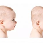 Hội chứng bẹt đầu ở trẻ sơ sinh! Bố mẹ cần lưu ý điều gì?