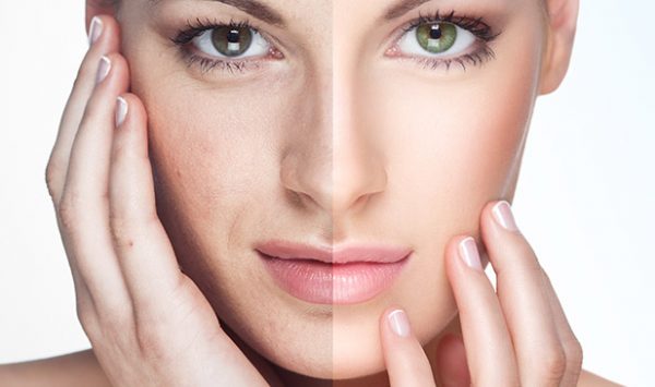 Không phải chỉ có người lớn tuổi mới bị lão hóa da