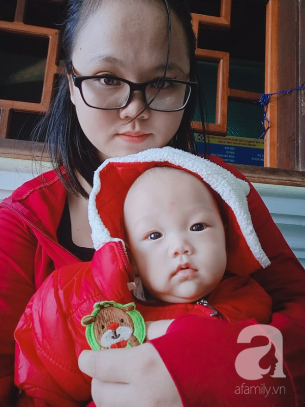 Mẹ trẻ bị liệt dây thần kinh số 7 vì chủ quan không kiêng cữ sau sinh