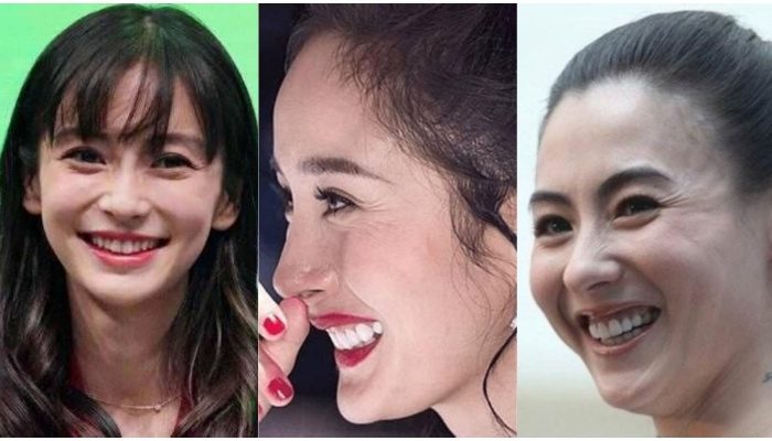 Tất tần tật những điều cần biết về nguyên nhân hình thành cũng như cách chống nếp nhăn cho chị em phụ nữ!