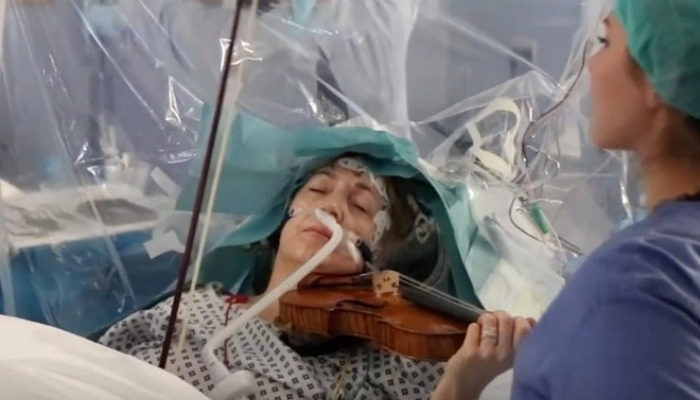Bệnh nhân thản nhiên chơi violin trong lúc bác sĩ cắt bỏ khối u não