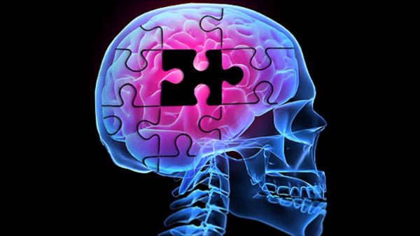 Alzheimer đang tấn công cả người trẻ - Chấn chỉnh ngay thói quen sống ngay nếu không muốn thoái hoá não vĩnh viễn!